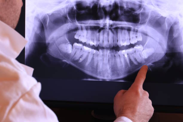 Best Emergency Treatment for Toothache in Lanark, IL